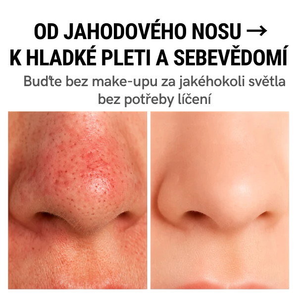 DermaClean: Čistič pleti